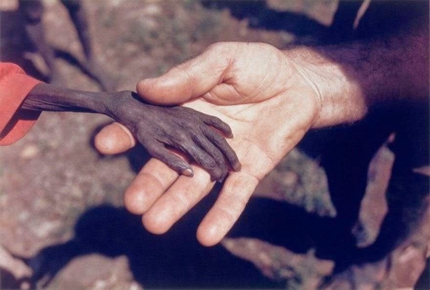 Starving Child