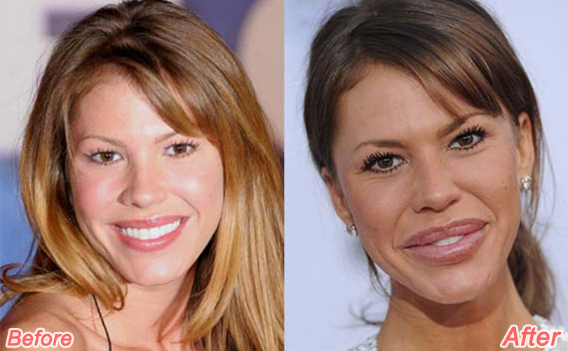 nikki-cox-before-after-plastic-surgery